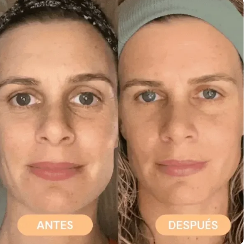 Masajeador facial LED + Masajeador Facial frio/calor Antiarrugas - LumiPulse | InovvaBeauty™